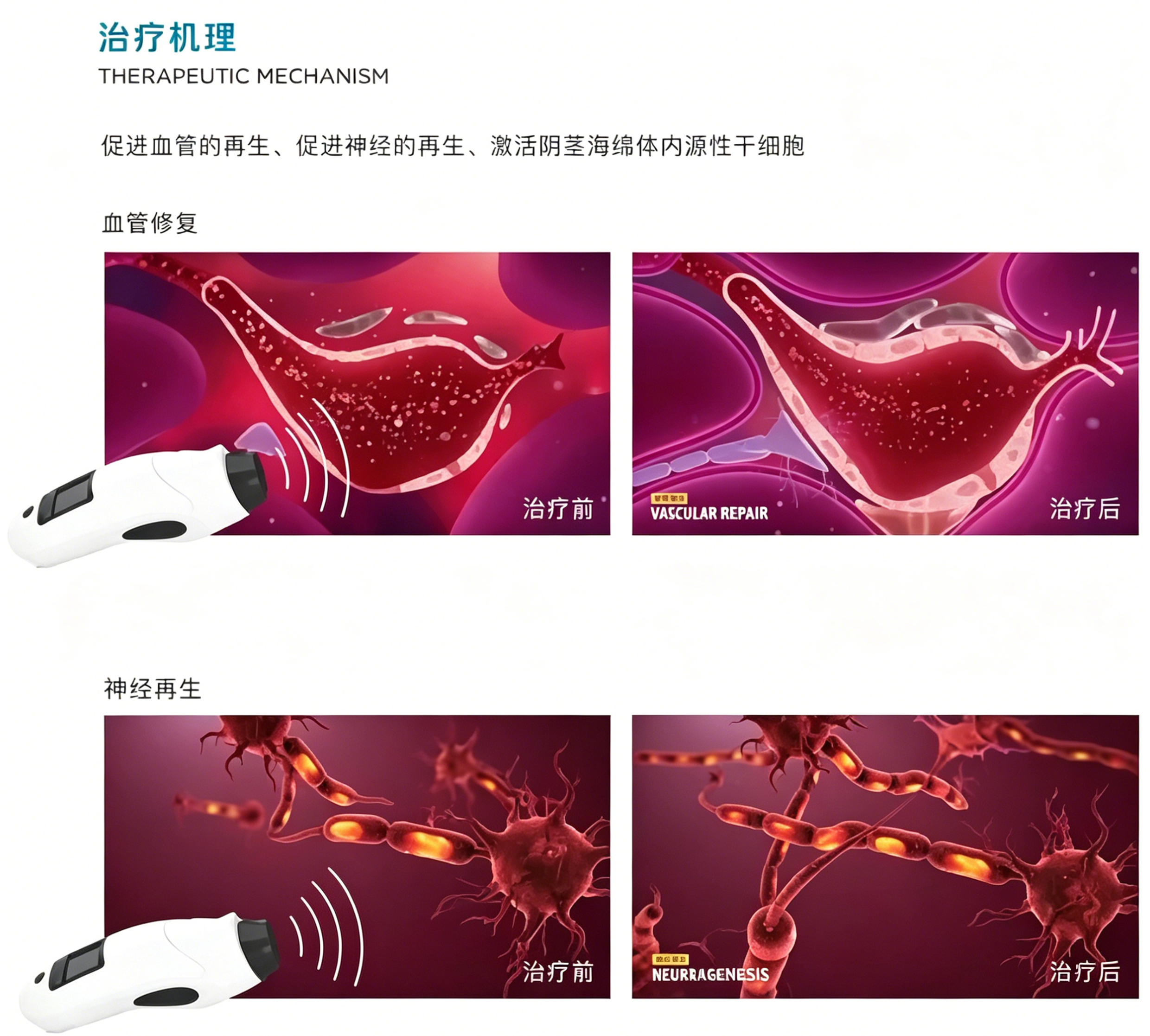 1782892941566604.jpg 治疗机理.jpg
