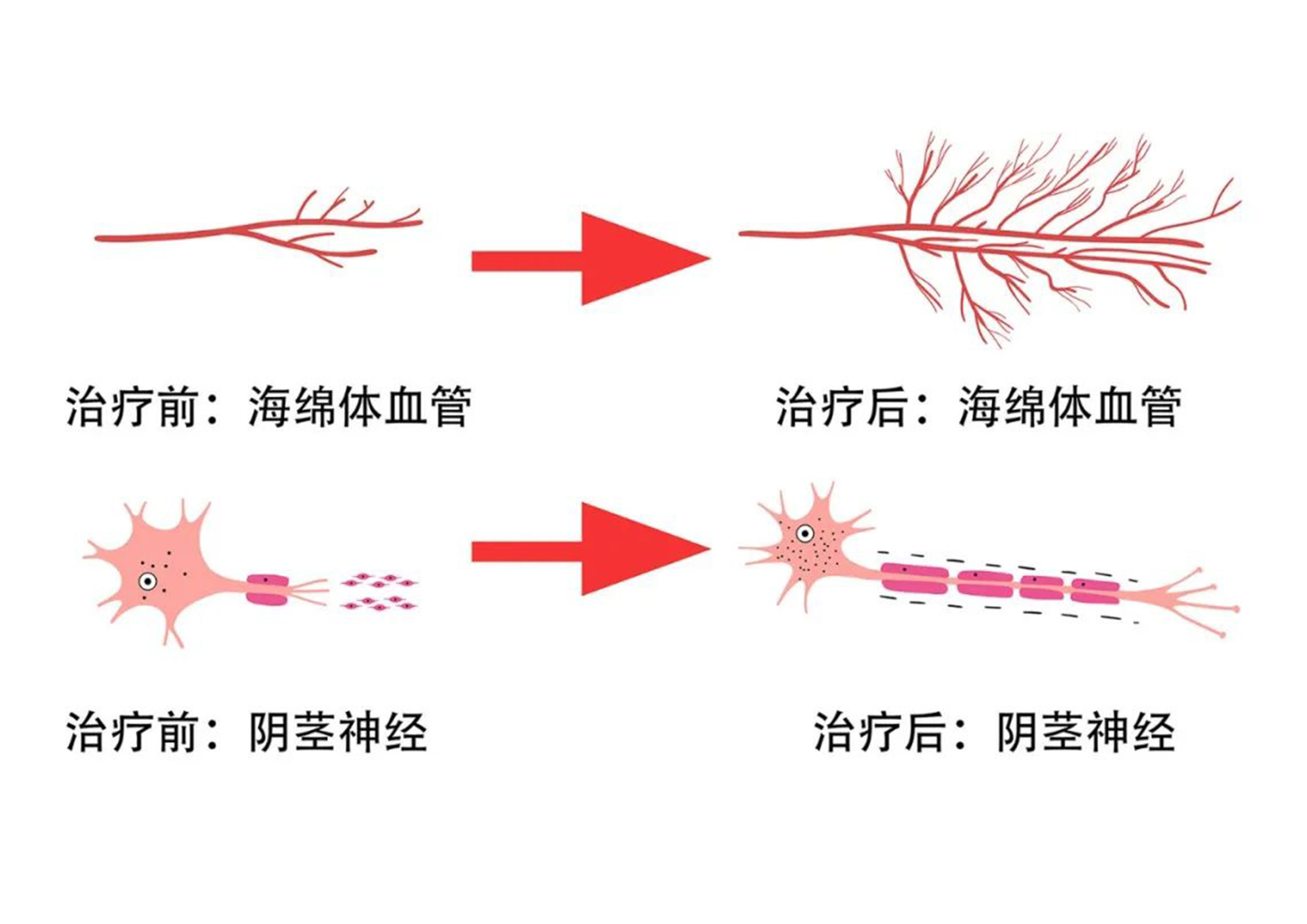 治疗前后 中文版.jpg